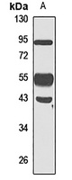 VASH1 Rabbit Polyclonal Antibody