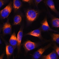 Anti-VAT1 Antibody
