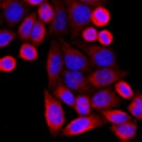 Anti-VDAC3 Antibody