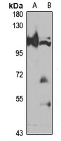 VLDLR Rabbit Polyclonal Antibody
