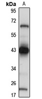 VMP1 Antibody