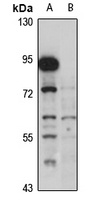 Vanin-1 Rabbit Polyclonal Antibody