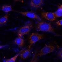 Anti-VPS25 Antibody