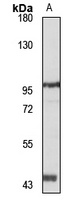 VPS51 Rabbit Polyclonal Antibody