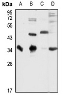 B7-H4 Rabbit Polyclonal Antibody