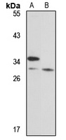 WBP2 Antibody