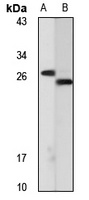 WBSCR27 Rabbit Polyclonal Antibody