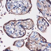 Anti-WDR61 Antibody