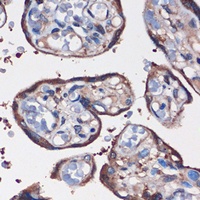 WDR61 antibody