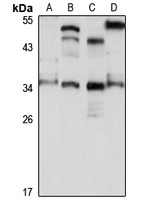 WDR82 Rabbit Polyclonal Antibody