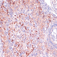 Anti-WNT10B Antibody