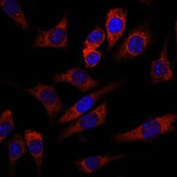 Anti-WNT10B Antibody