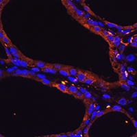 Anti-Wnt-5a Antibody