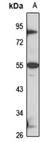 WTAP Rabbit Polyclonal Antibody