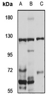 XPO7 Rabbit Polyclonal Antibody