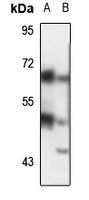c-Yes Rabbit Polyclonal Antibody