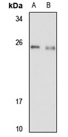 YKT6 Rabbit Polyclonal Antibody