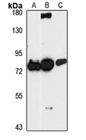 HCCA2 Rabbit Polyclonal Antibody