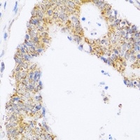 Anti-ZAK Antibody