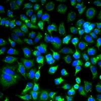 Anti-ZAK Antibody
