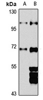 MIZ-1 Rabbit Polyclonal Antibody
