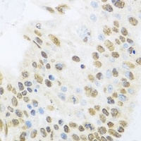 Anti-MIZ-1 Antibody