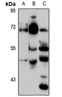ZBTB44 Rabbit Polyclonal Antibody