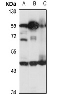ZBTB6 Rabbit Polyclonal Antibody
