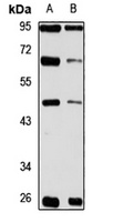 ZC3H12A Rabbit Polyclonal Antibody