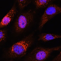 Anti-ZC3H12D Antibody