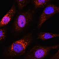 ZC3H12D antibody