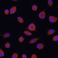 ZCCHC3 Antibody