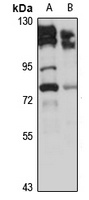 ZCCHC8 Rabbit Polyclonal Antibody