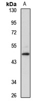 ZFYVE27 Rabbit Polyclonal Antibody
