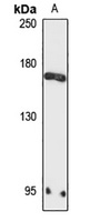 ZMYM3 Antibody
