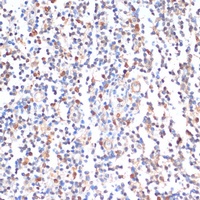 Anti-ZMYM3 Antibody