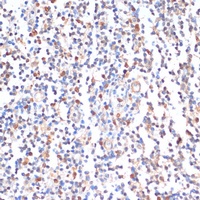 ZMYM3 antibody