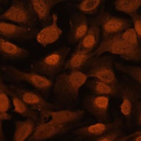 Anti-ZNF131 Antibody