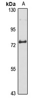 ZNF16 Rabbit Polyclonal Antibody