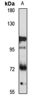 ZNF189 Rabbit Polyclonal Antibody