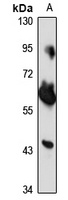 ZNF248 Rabbit Polyclonal Antibody