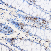 Anti-ZNF263 Antibody