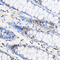 ZNF263 antibody