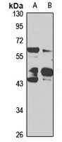 ZNF324 Rabbit Polyclonal Antibody