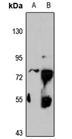 ZNF551 Rabbit Polyclonal Antibody