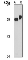 ZNF563 Rabbit Polyclonal Antibody