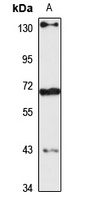 ZNF599 Rabbit Polyclonal Antibody