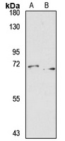 ZNF677 Rabbit Polyclonal Antibody