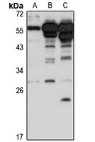 ZNF688 Rabbit Polyclonal Antibody