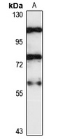 ZNF703 Rabbit Polyclonal Antibody